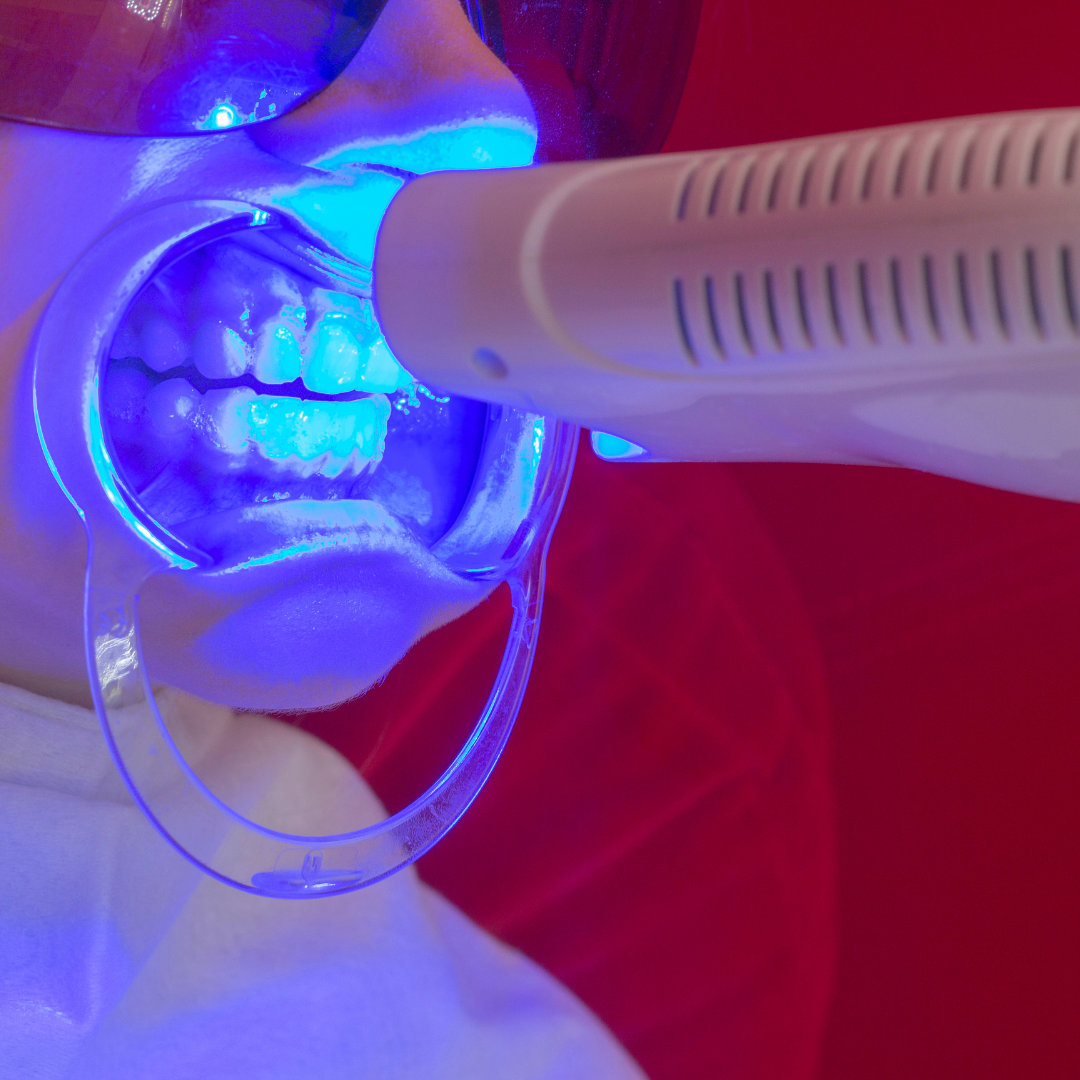 Pro Whitening Lamps